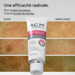 کرم ضد لک و روشن‌ کننده ای سی ام ACM Depiwhite Advanced Intensive Anti-Dark Spot Cream